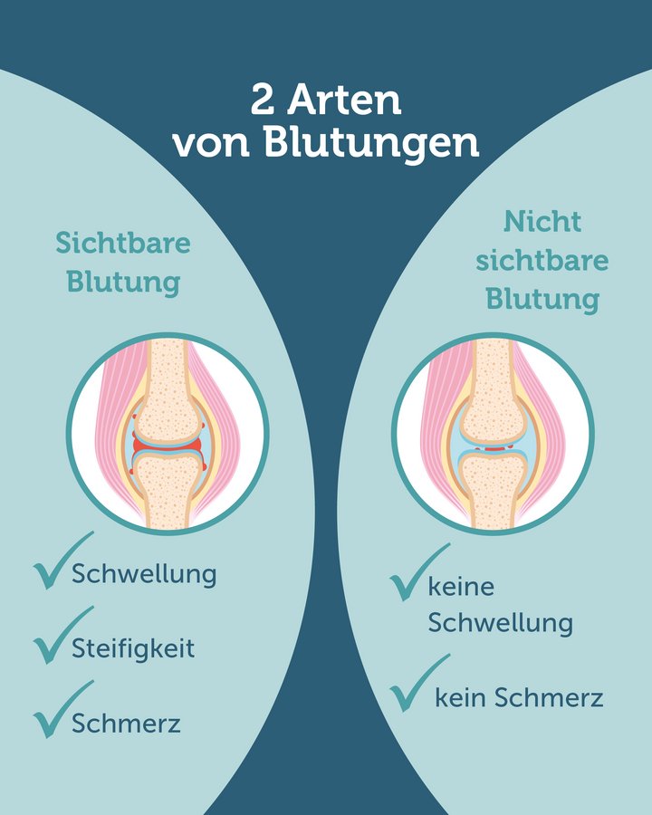 Mikroblutungen.jpg