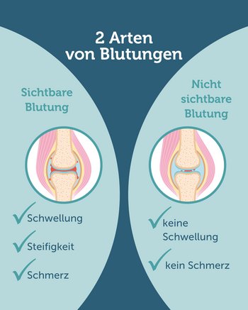 Mikroblutungen erkennen und verhindern